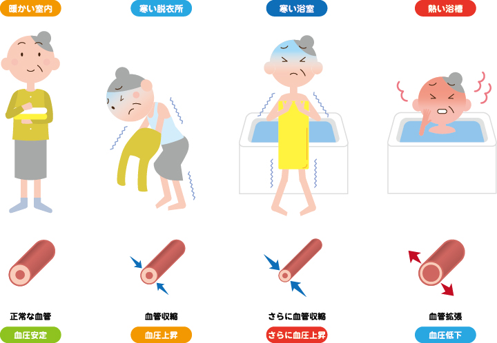 ヒートショック